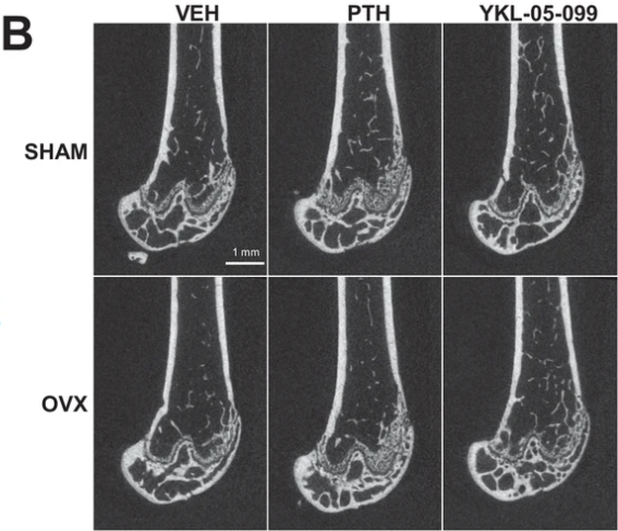 Dual targeting of salt inducible kinases and CSF1R uncouples bone formation and bone resorption
