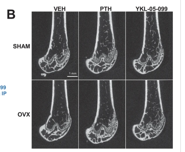 Dual Targeting Of Salt Inducible Kinases And CSF1R Uncouples Bone Formation And Bone Resorption